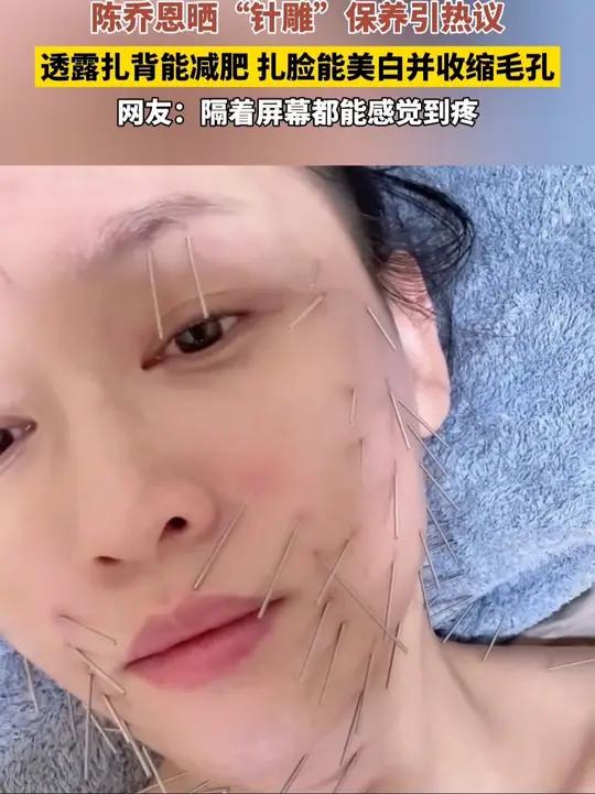 6月6日(发布)北京,陈乔恩晒“针雕”保养引热议,透露扎背能减肥,扎脸能美白并收缩毛孔,网