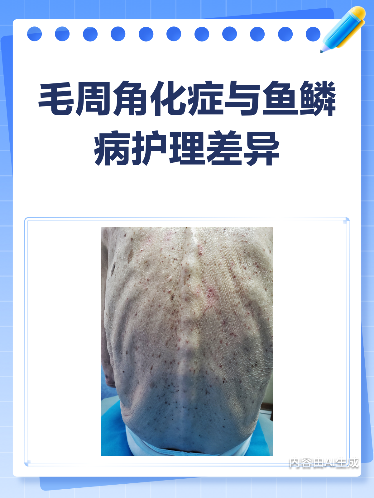 鸡皮肤&鱼鳞病怎么护?看这篇就够啦!