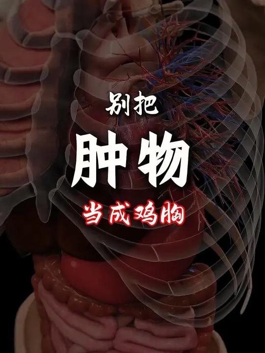 孩子胸部有凸起,容易被误认为是鸡胸!不能大意,更不应该盲目进行补钙,到医院做必要的检查很有