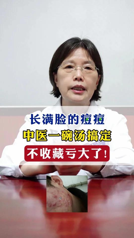 长满脸的痘痘,中医一碗汤搞定,不收藏就亏大了!