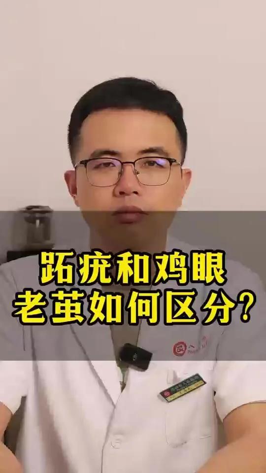 一条视频教你区分跖疣和鸡眼