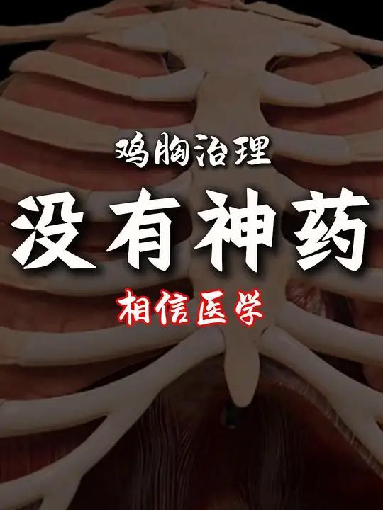 严重的鸡胸,不是打针吃药的事情!不要等到到了再看,要早看!一定要纠正错误的观念!治疗鸡胸没