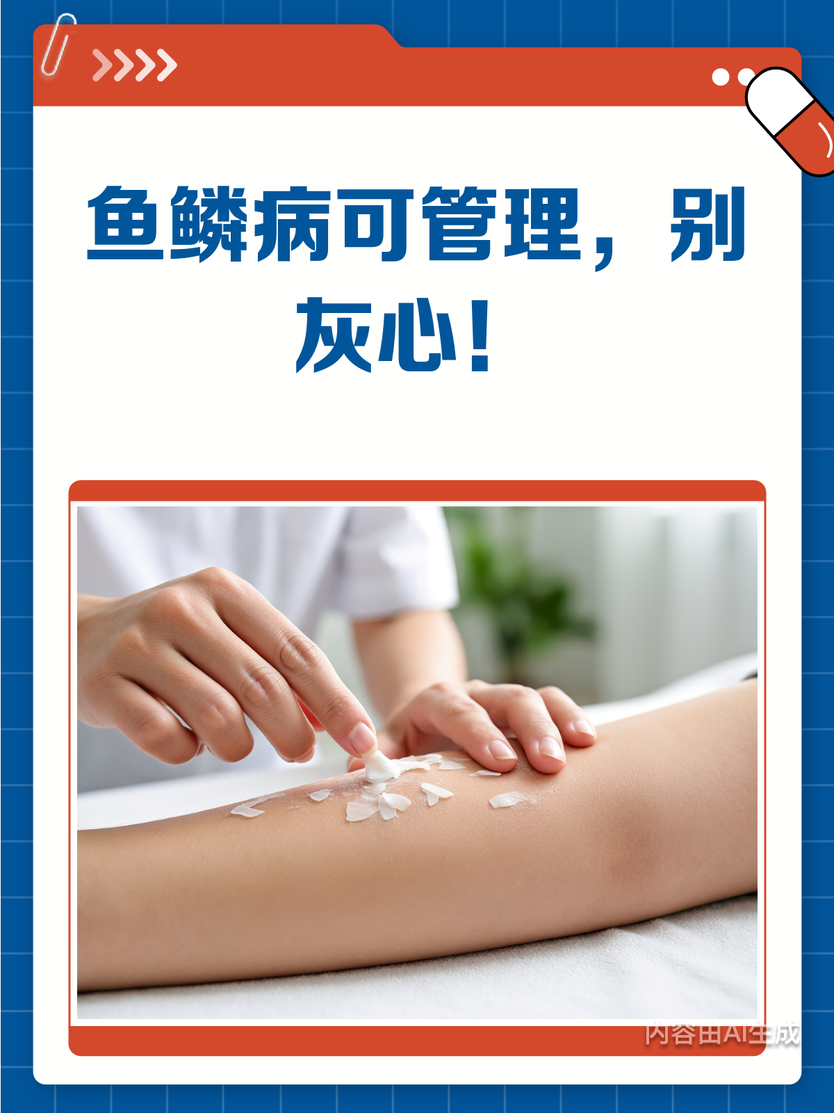 鱼鳞病无法治疗?别灰心,管理有方!