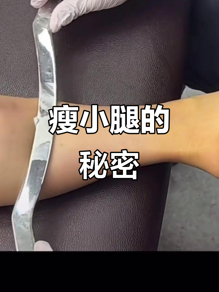 小腿肌肉松解术,轻松打造修长美腿