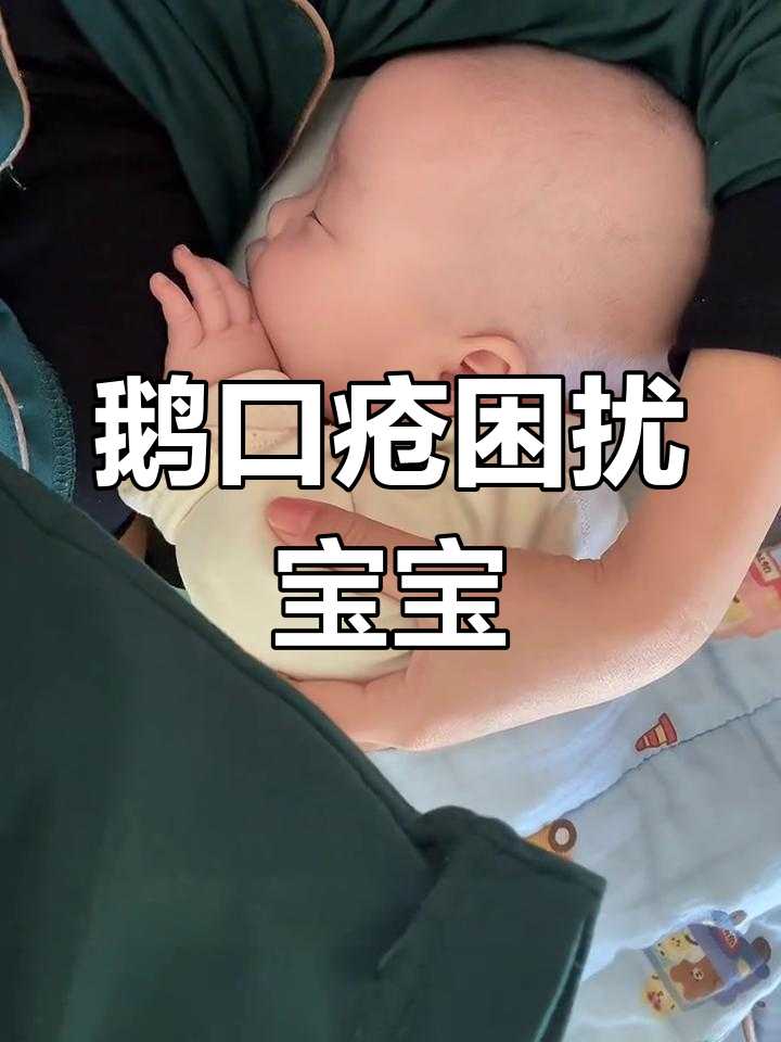 宝宝鹅口疮持续三个月,疫苗接种受阻,何时能痊愈?
