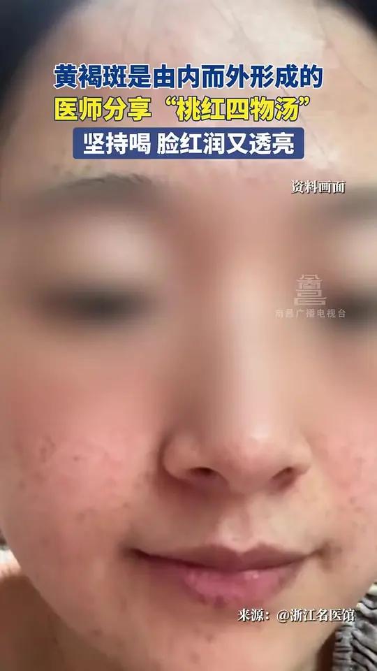 黄褐斑是由内而外形成的,医师分享“桃红四物汤”,坚持喝 脸红润又透亮