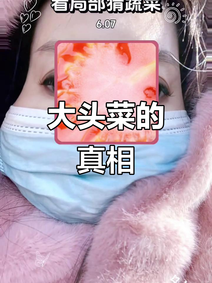 东北大头菜到底是啥?看完这些蔬菜,你就懂了