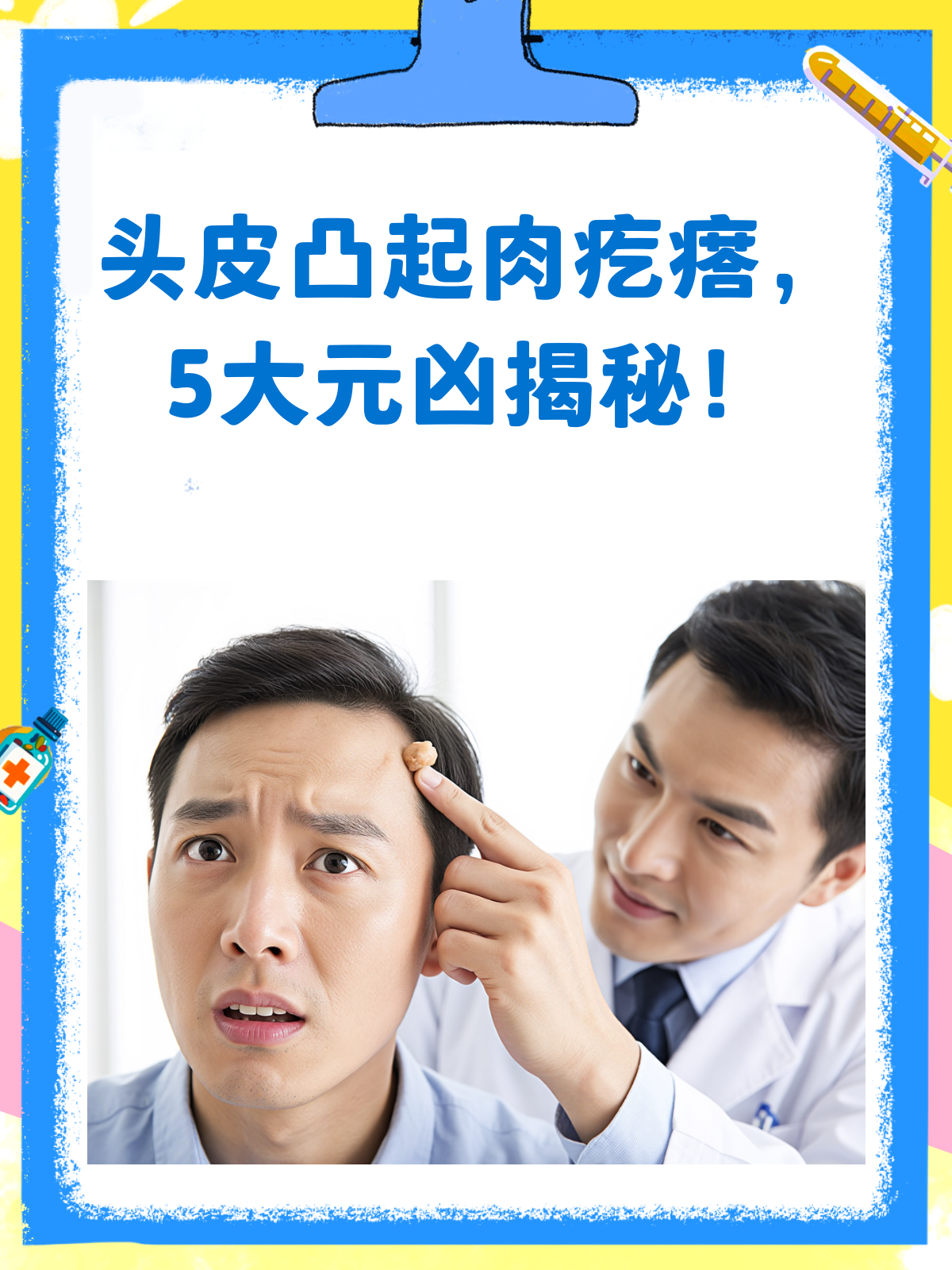 头皮上的肉疙瘩？揭秘背后的5大“元凶”！