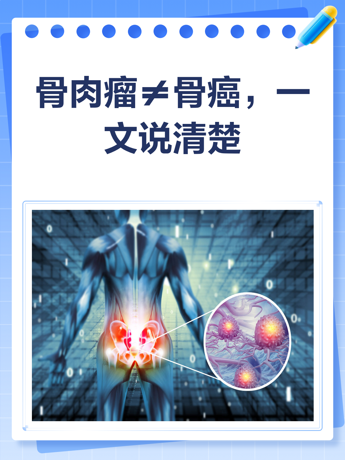 骨肉瘤≠骨癌？一文带你搞清楚！