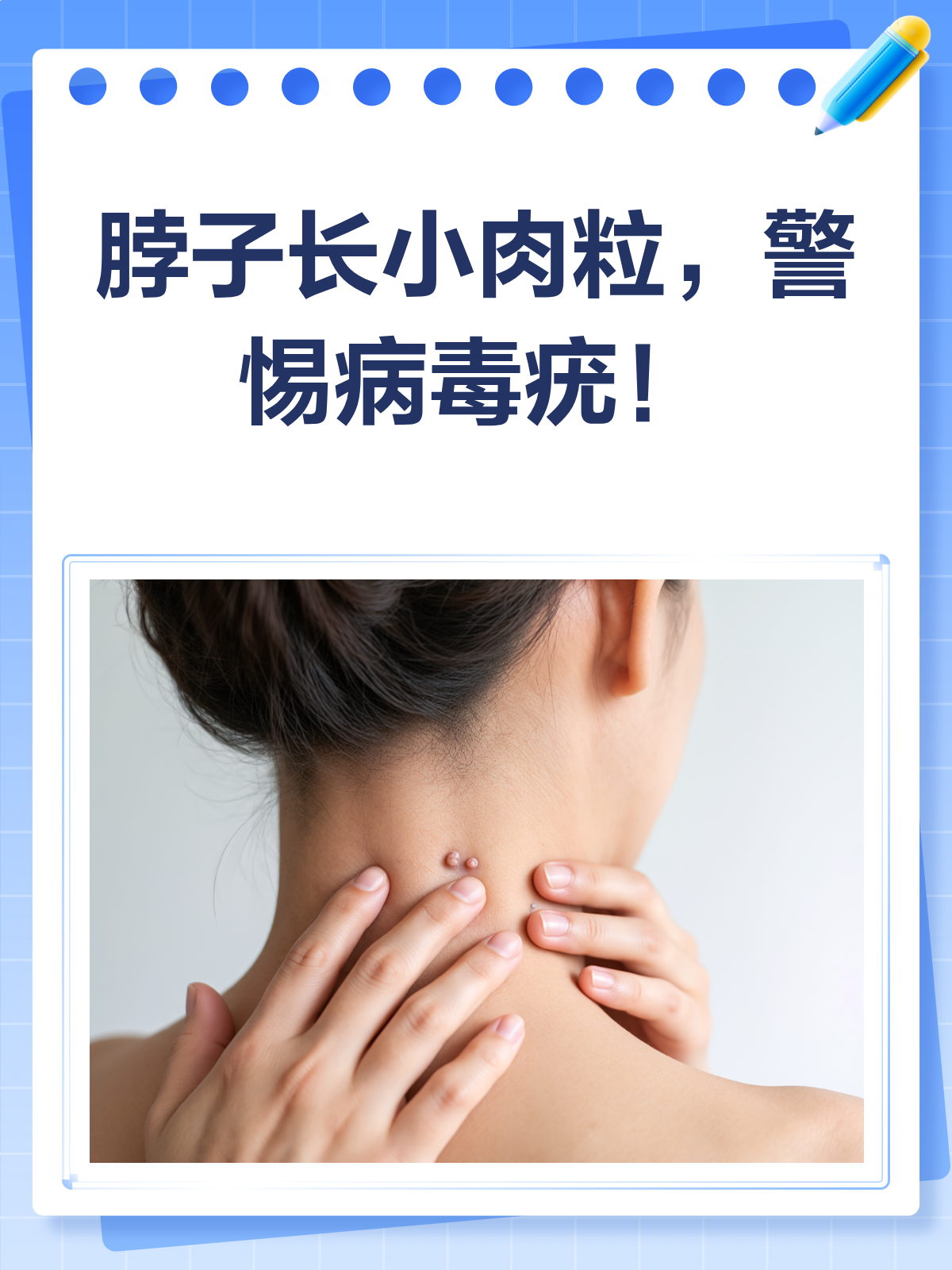 脖子长小肉粒?警惕!可能是病毒疣在作祟