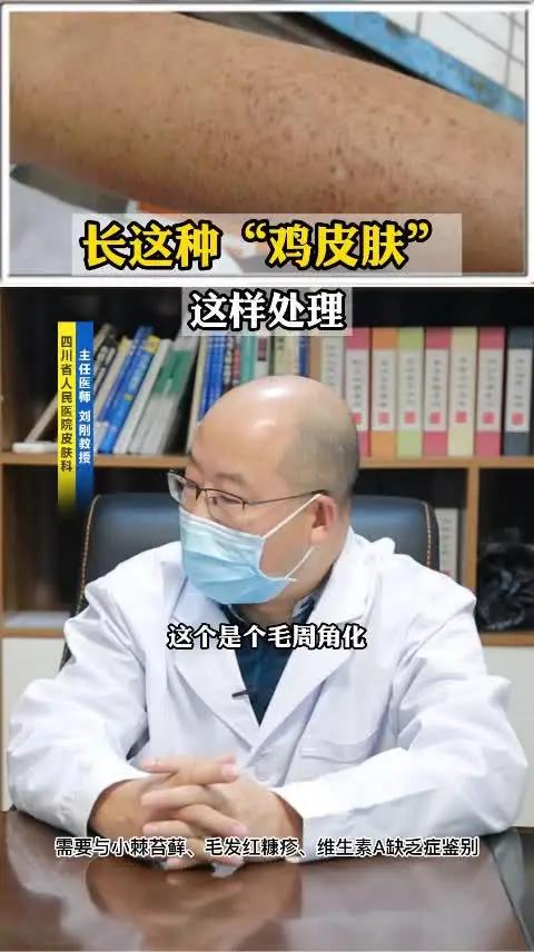 手臂上长这种“鸡皮肤”,我们叫做“毛周角化”,很影响美观,可以这样处理 毛周角化