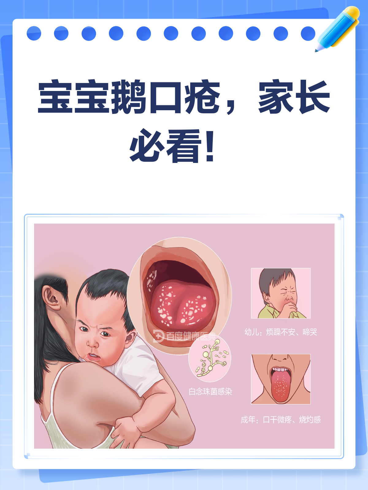 宝宝得了鹅口疮怎么办?别急,看这里!