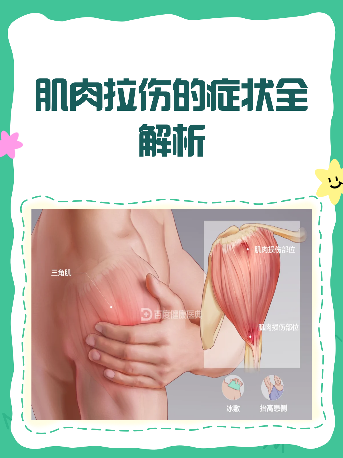 肌肉拉伤来袭?这些症状你得知道!