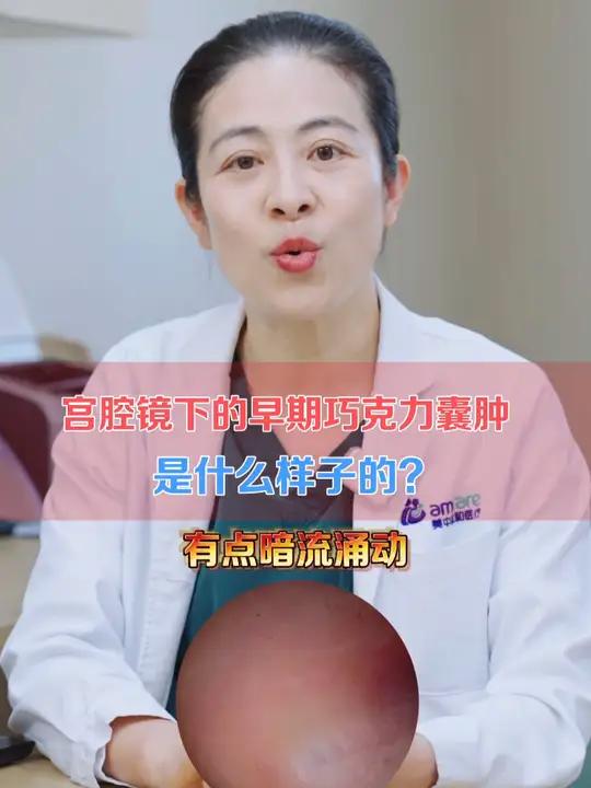 宫腔镜下的早期巧克力囊肿是什么样子的?