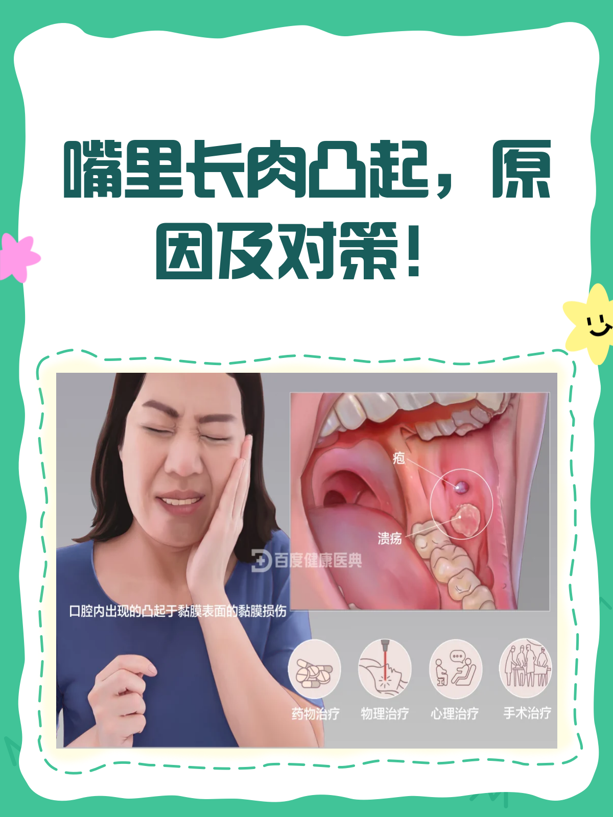 嘴里长了个肉凸起?别急,先来看看这个!