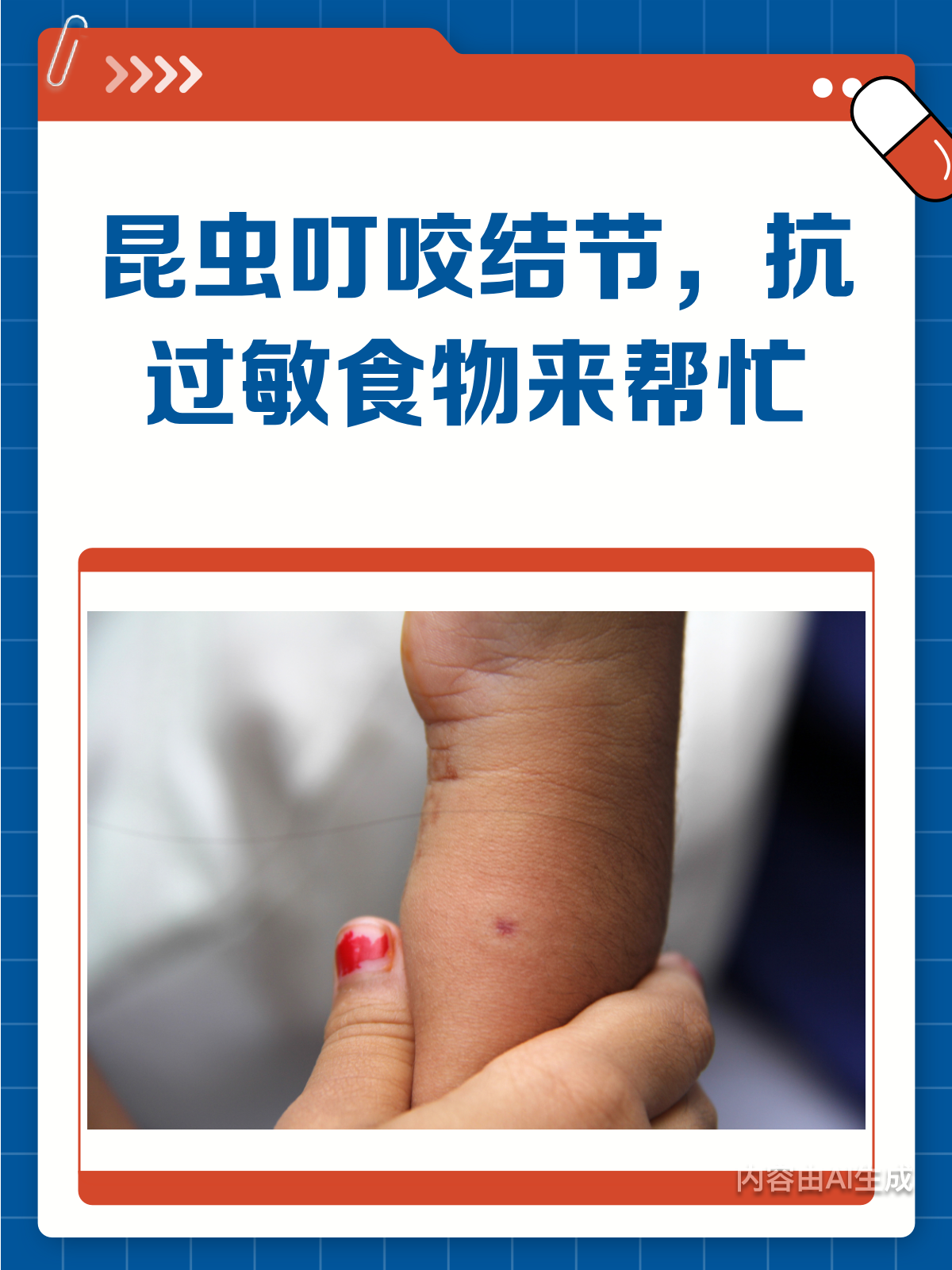 昆虫叮咬起结节?这些抗过敏食物来帮忙!