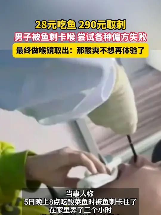4月6日,上海,28元吃鱼 290元取刺,男子被鱼刺卡喉 尝试各种偏方失败,最终做喉镜取出