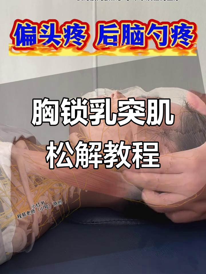胸锁乳突肌松解技巧,轻松缓解肌肉紧张