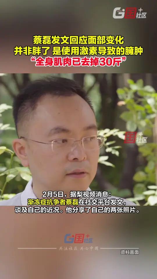 2月5日,渐冻症抗争者蔡磊在社交平台发文,表示全身肌肉相较刚患病时掉了近30斤:渐冻症瘫痪