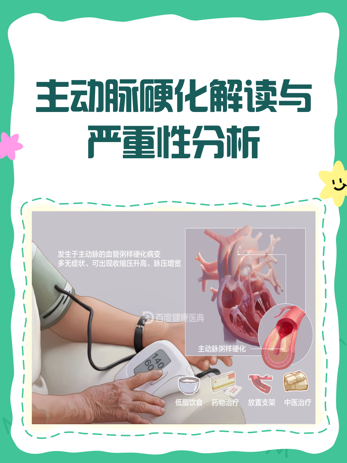 主动脉硬化,你真的了解吗?