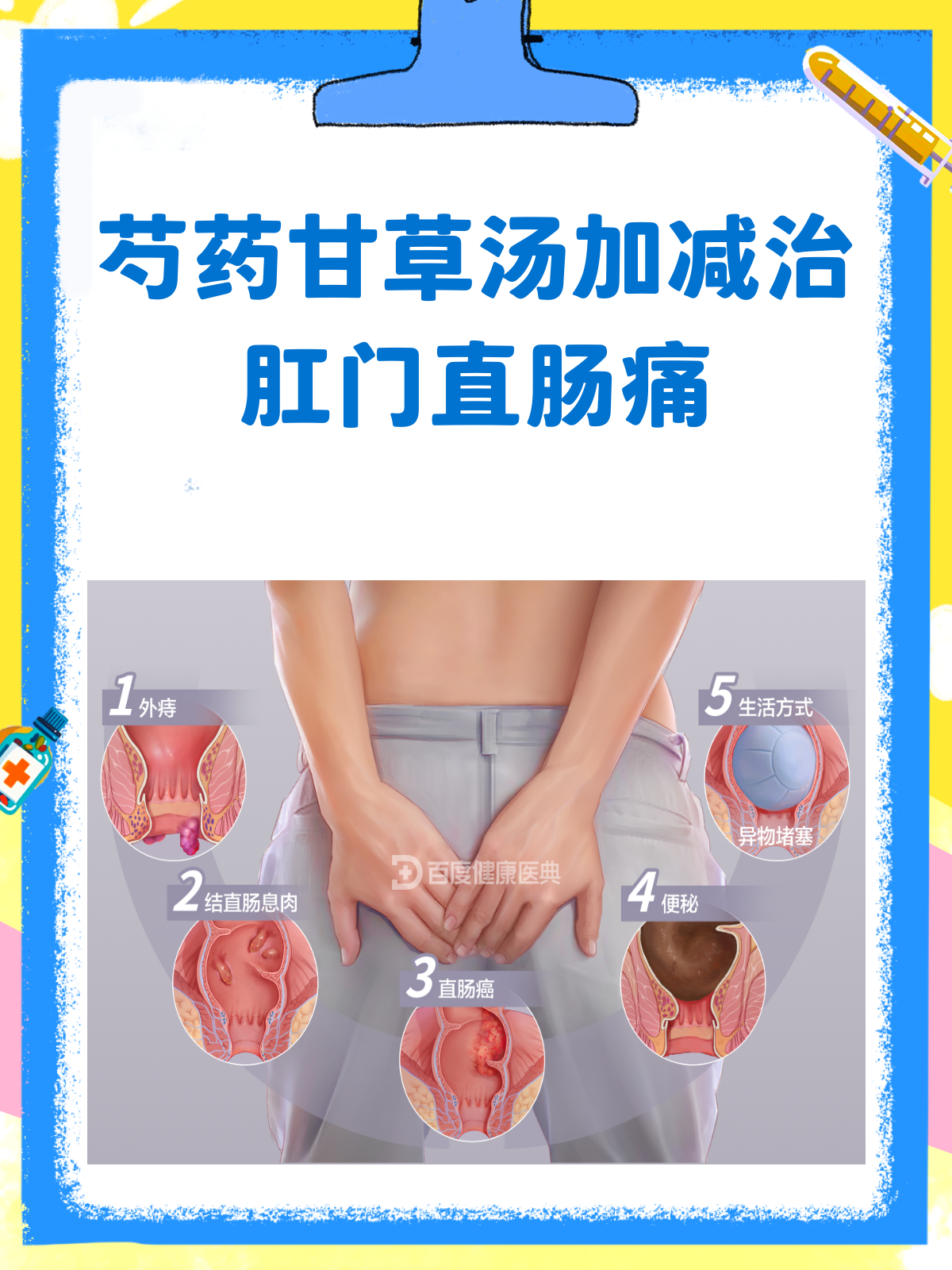 肛门直肠痛?试试芍药甘草汤的加减妙方!