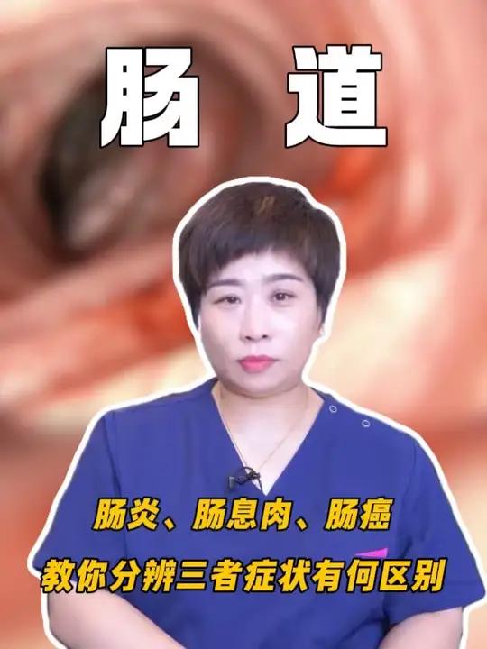 肠炎、肠息肉、肠癌 教你分辨三者症状有何区别