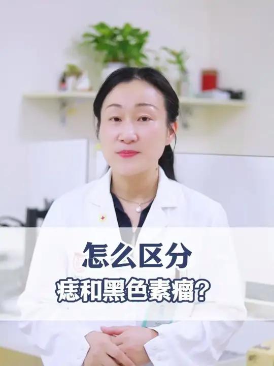 正常的痣和黑色素瘤怎么区分?