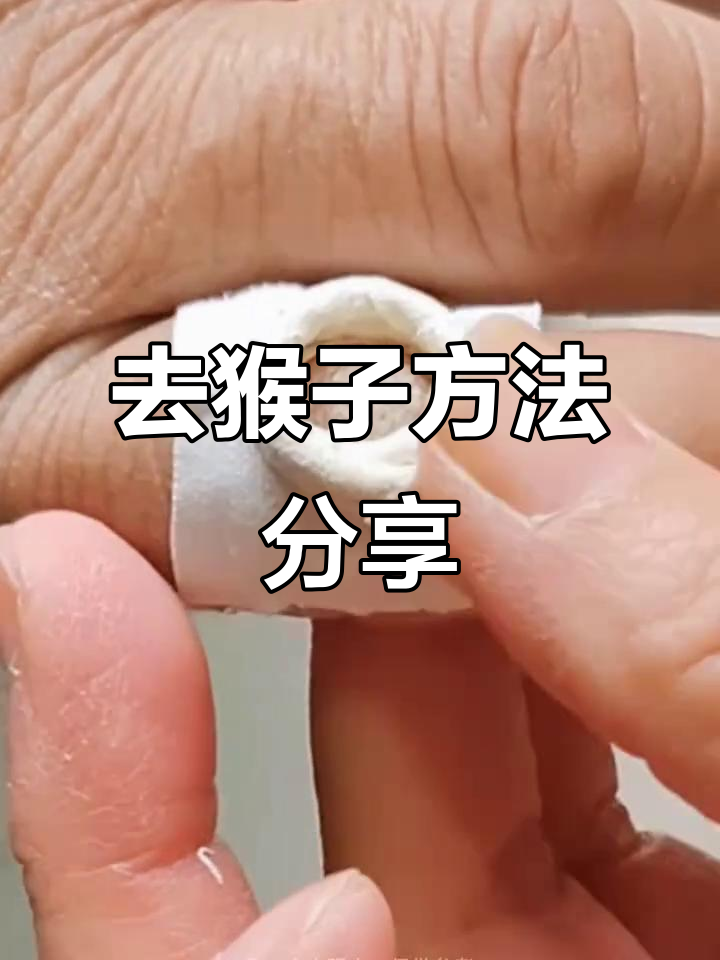 跖疣封包技巧大揭秘,轻松去除顽固肉刺
