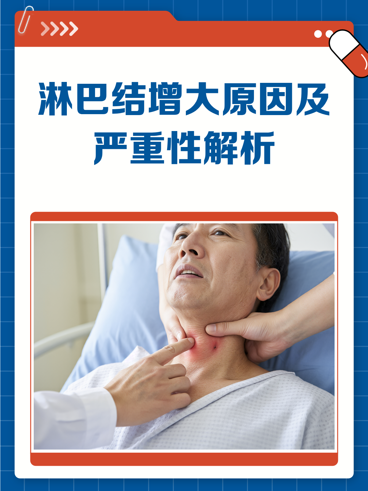 淋巴结增大,原因多样,严重度因病因异!