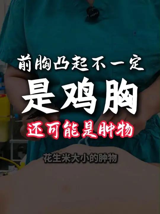 2岁宝宝胸部凸起,家长开始以为是鸡胸,检查发现是肿物,已切除,接触过不少鸡胸和肿物分不清的