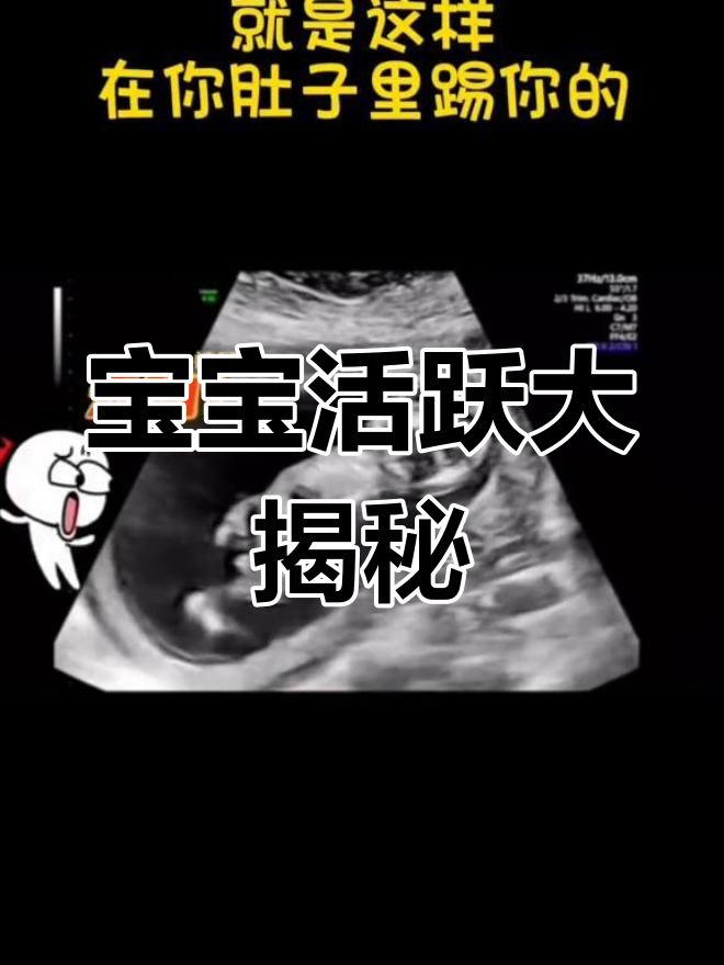 15周胎儿在肚子里欢快舞动,活力满满!