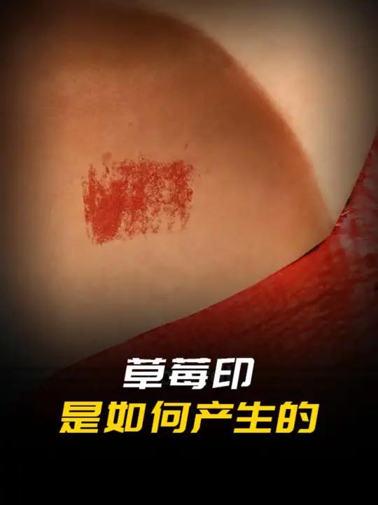 草莓印是如何形成的