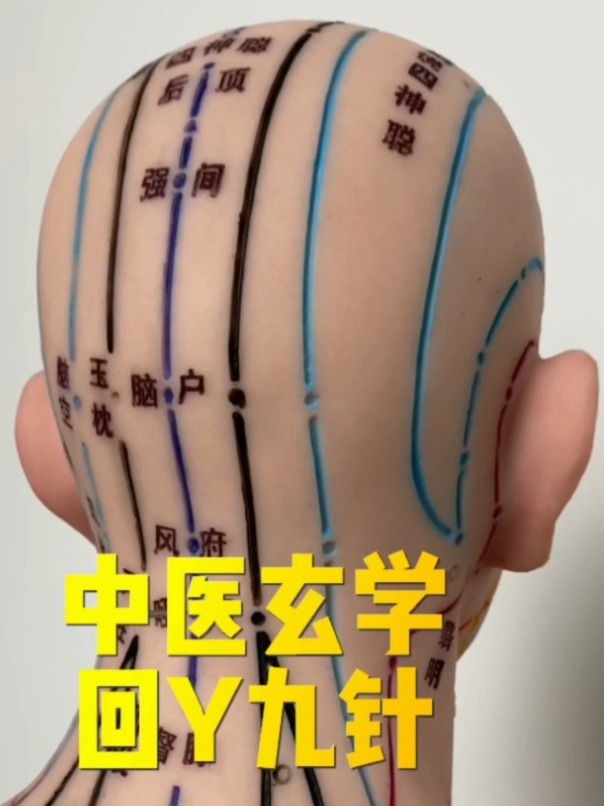 针灸技法 解读回阳九针