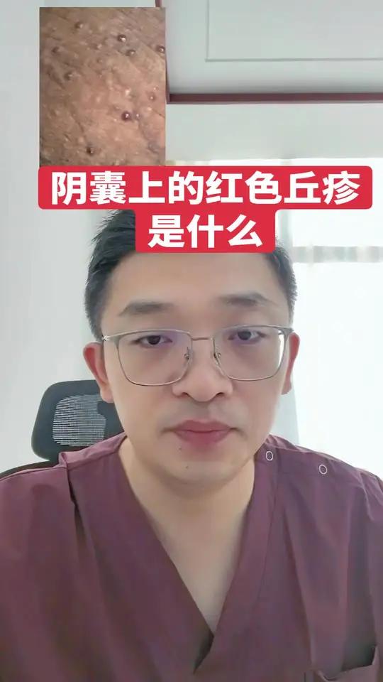 阴囊上的红色丘疹是什么?