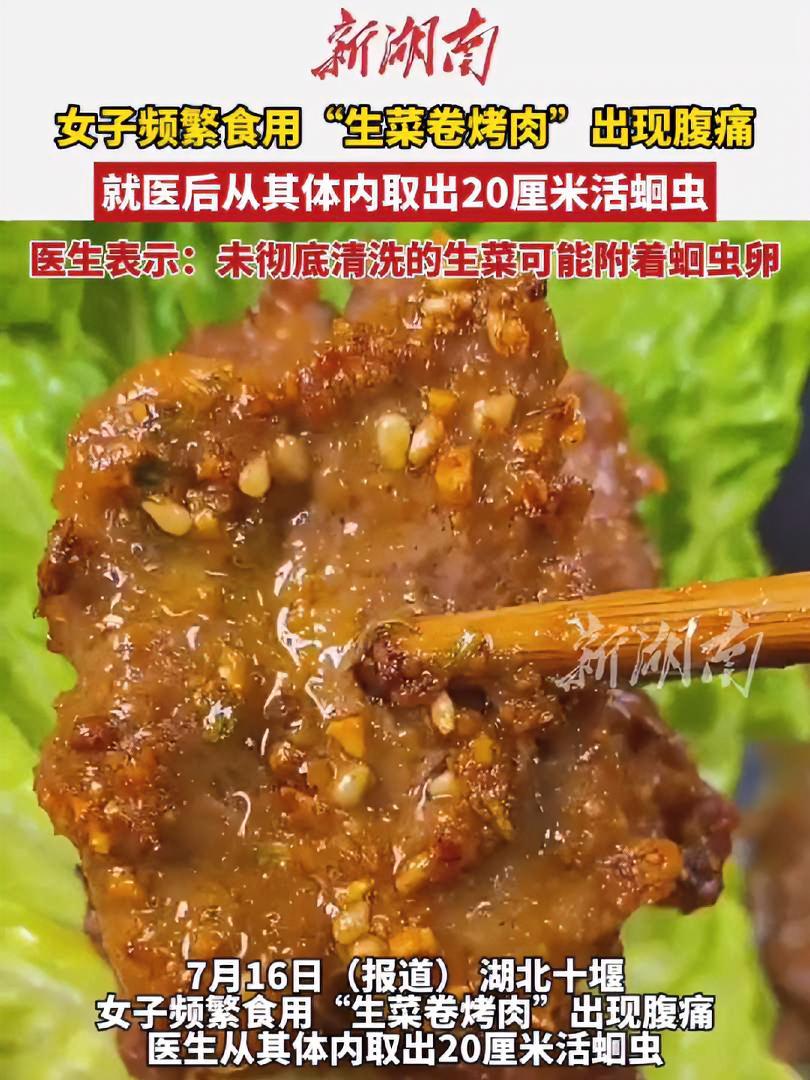 女子频繁食用“生菜卷烤肉”出现腹痛,就医后从其体内取出20厘米活蛔虫。医生表示:未彻底清洗