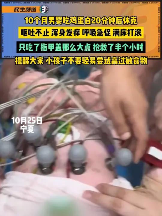 10个月男婴吃鸡蛋白20分钟后休克,呕吐不止、浑身发痒、呼吸急促、满床打滚,只吃了指甲盖那