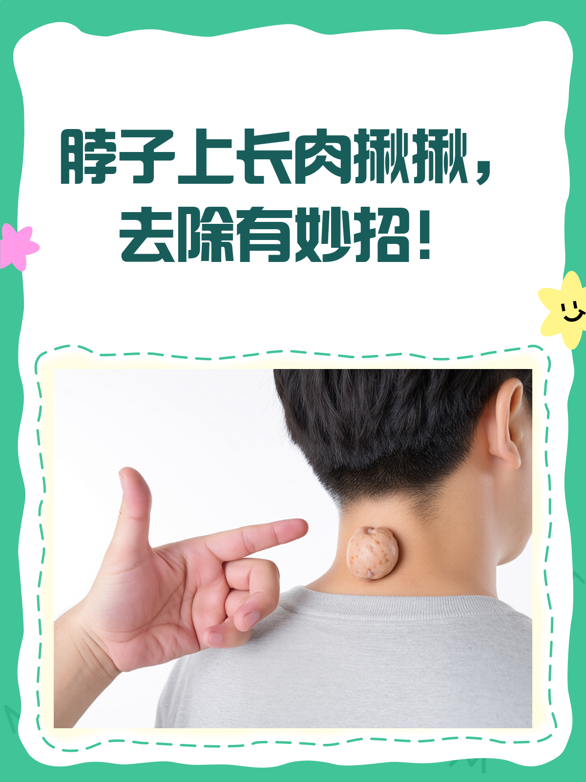 脖子上的小揪揪太烦人?教你几招轻松去除!