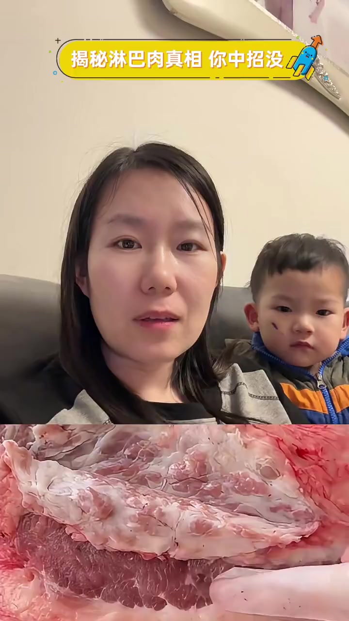 揭秘淋巴肉真相,你中招没