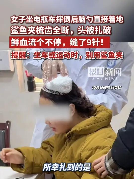 女子坐电瓶车摔倒,后脑勺直接着地,鲨鱼夹梳齿全断,头被扎破,鲜血流个不停,缝了9针!提醒: