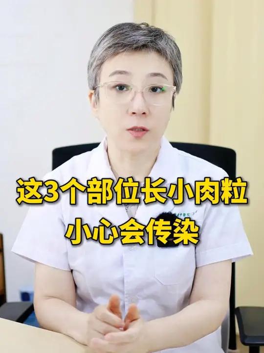 身上这3个部位长小肉粒,可能是病毒感染,会传染!皮肤科医生教你处理
