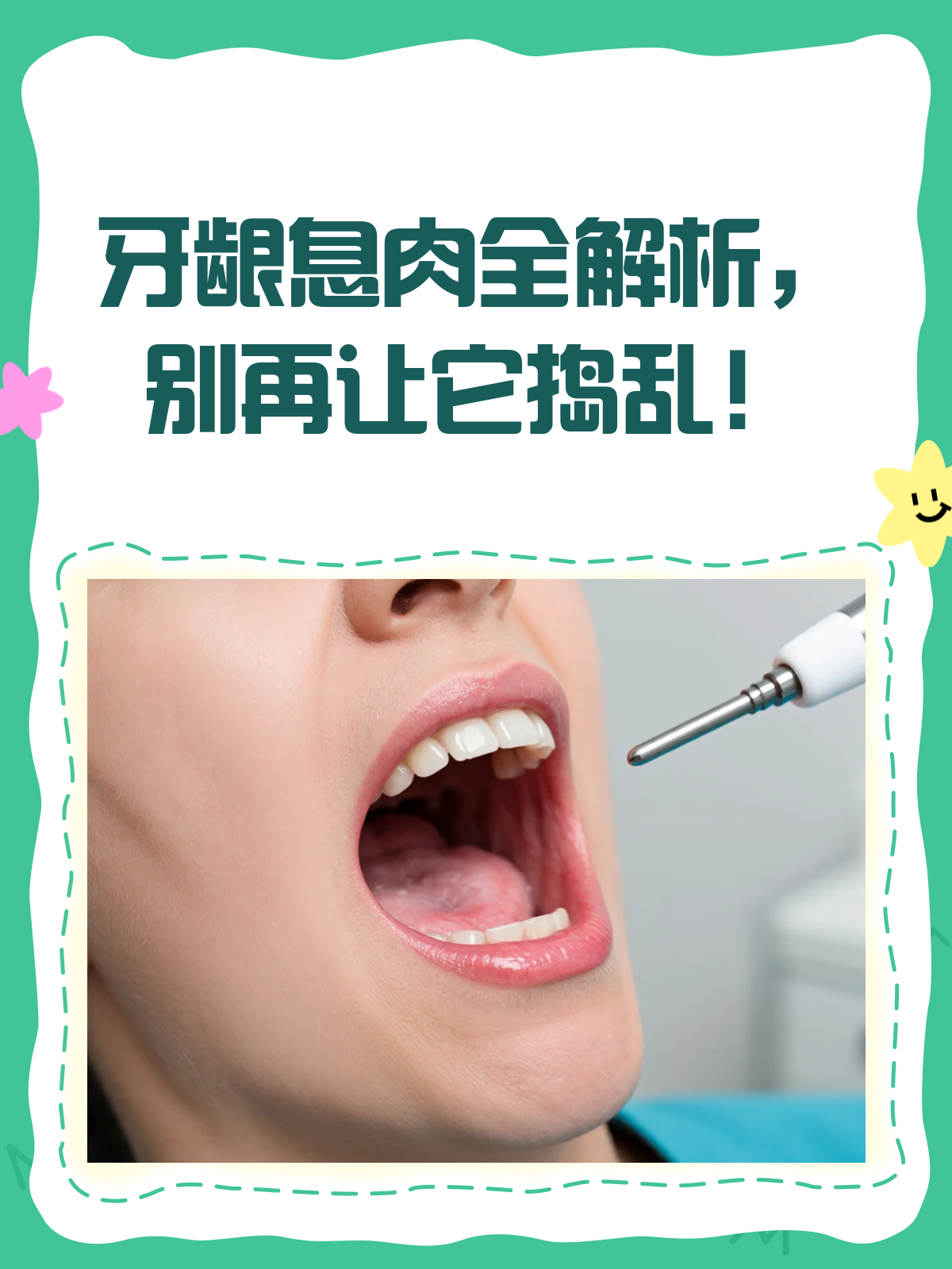 牙龈上的“不速之客”牙龈息肉知多少？