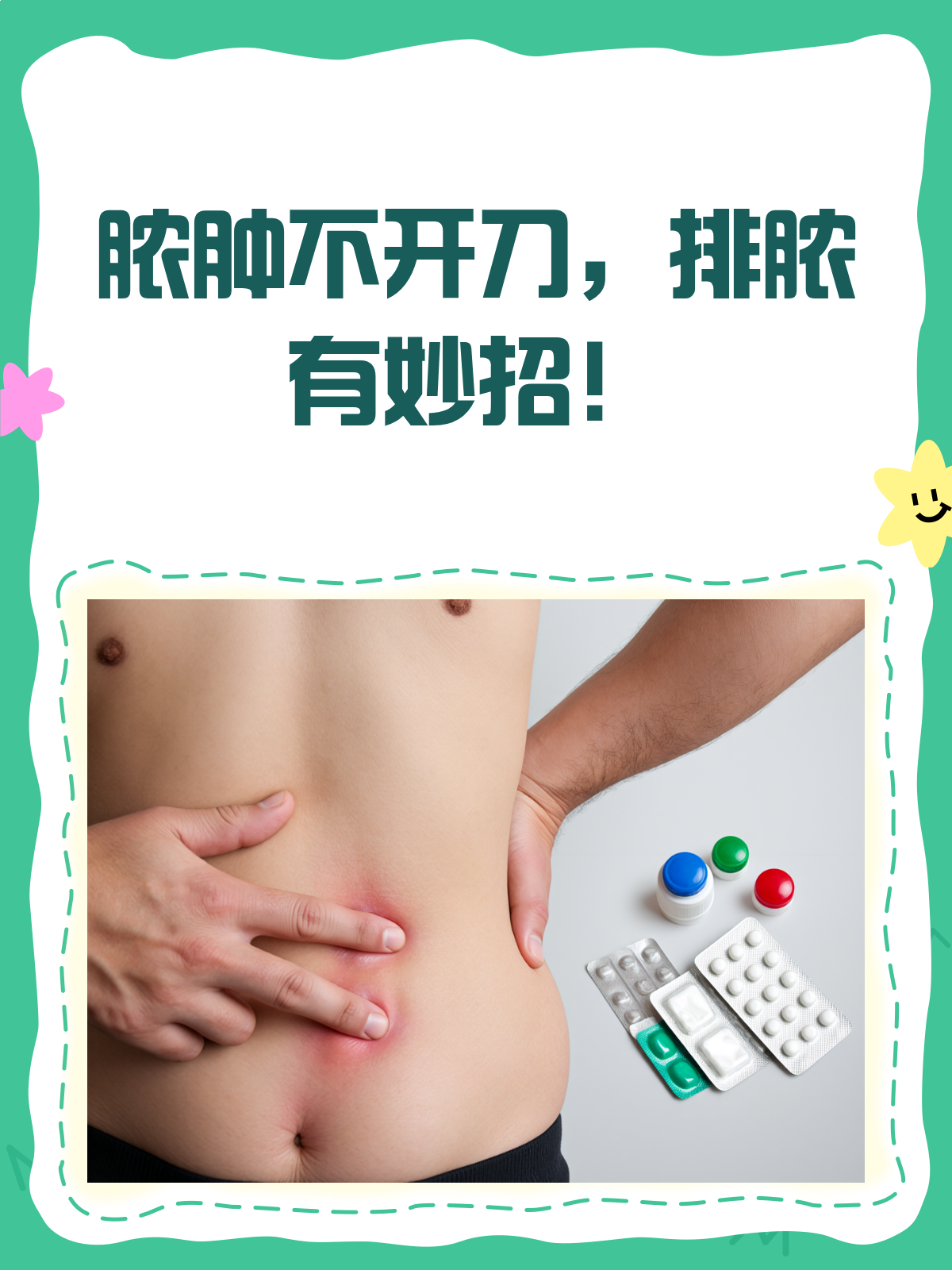 脓肿不切开？这些排脓小妙招快收藏！