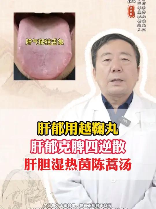 肝郁用越鞠丸,肝郁克脾四逆散,肝胆湿热茵陈蒿汤 #肝郁 #抖出健康知识宝藏 #中医