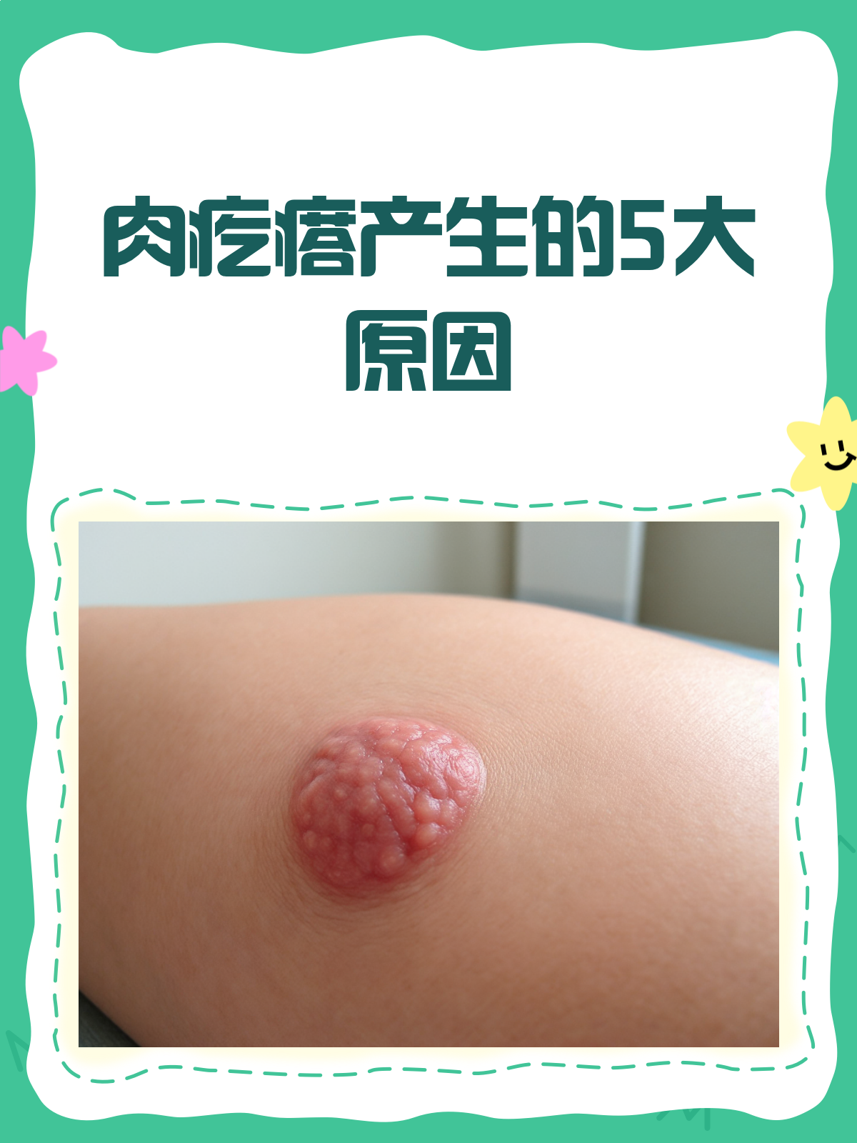 皮肤长肉疙瘩?原因竟有这些!