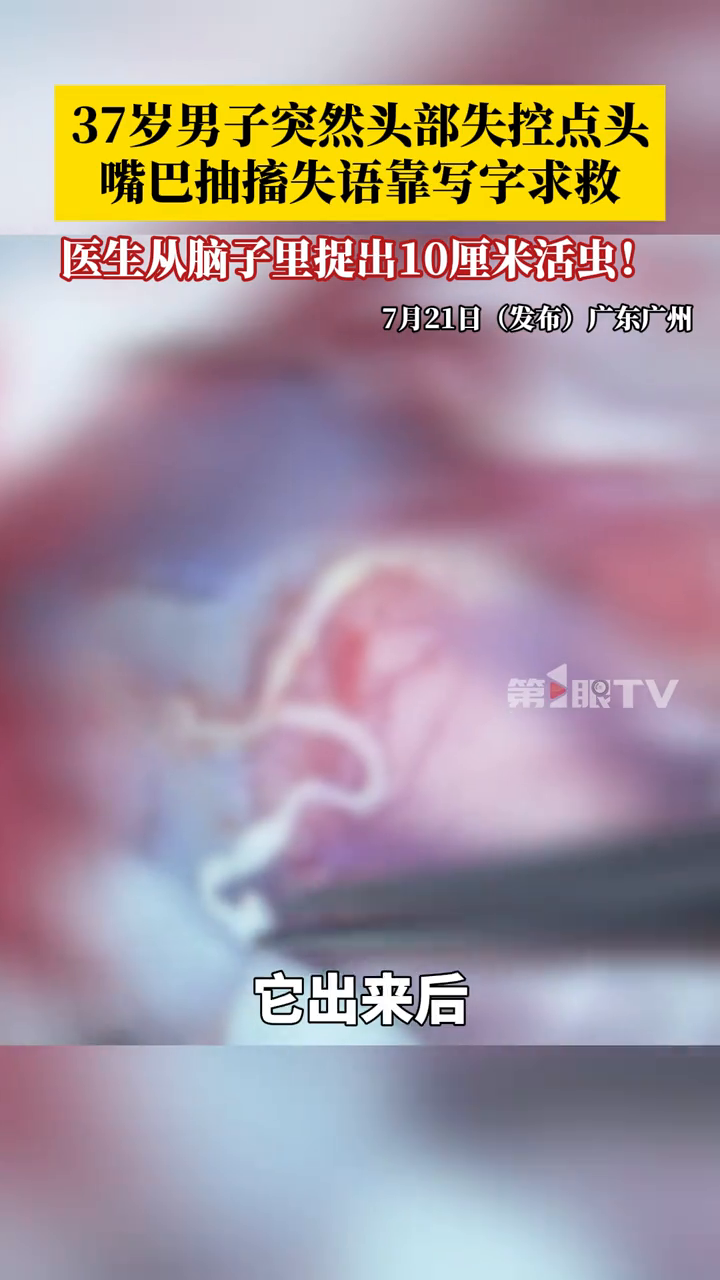 37岁男子突然头部失控不断点头,嘴巴抽搐失语靠写字求救