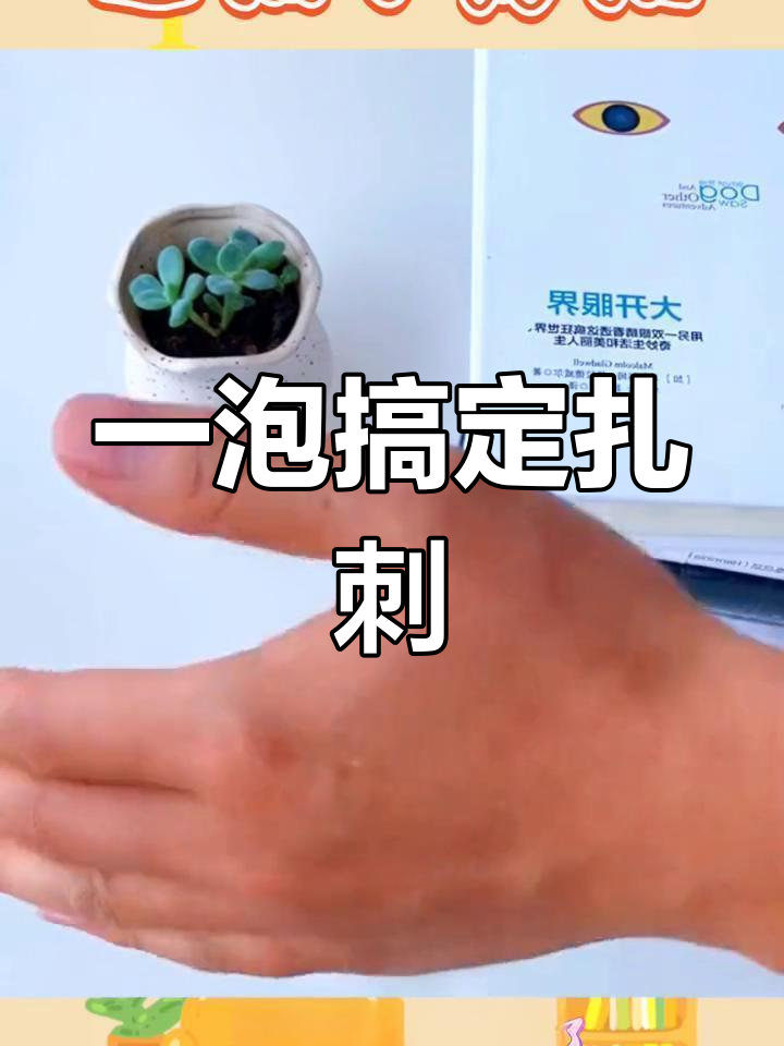 手指扎刺轻松去除,食盐白醋有妙招