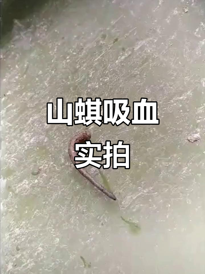 爬山遇险!吸满血的山蜞让人毛骨悚然