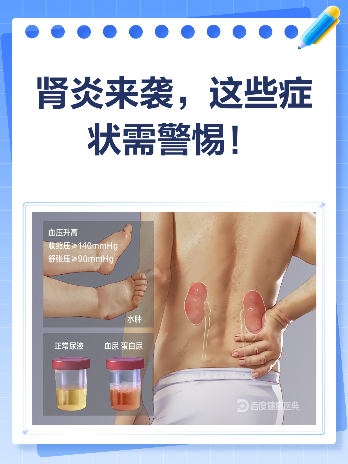 肾炎来袭,你的身体会有哪些“警报”?