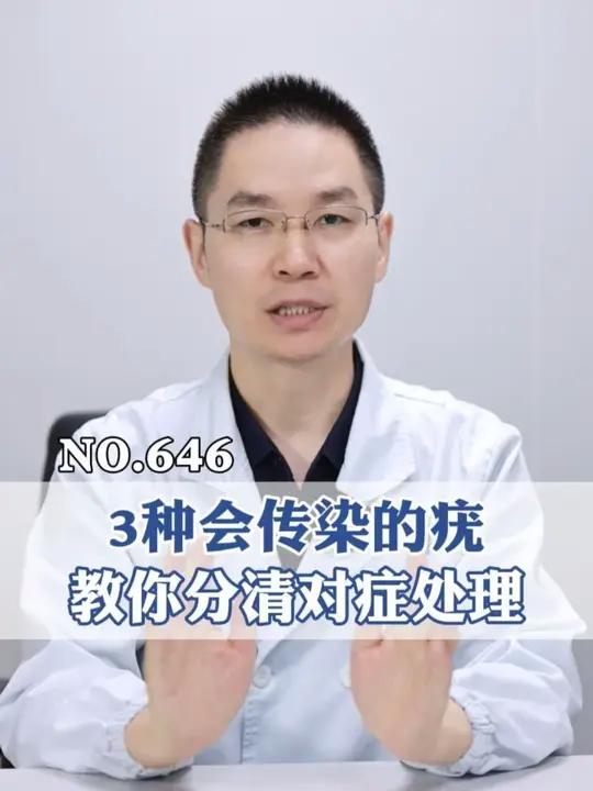 这3种会传染的疣，分清楚才能正确处理 