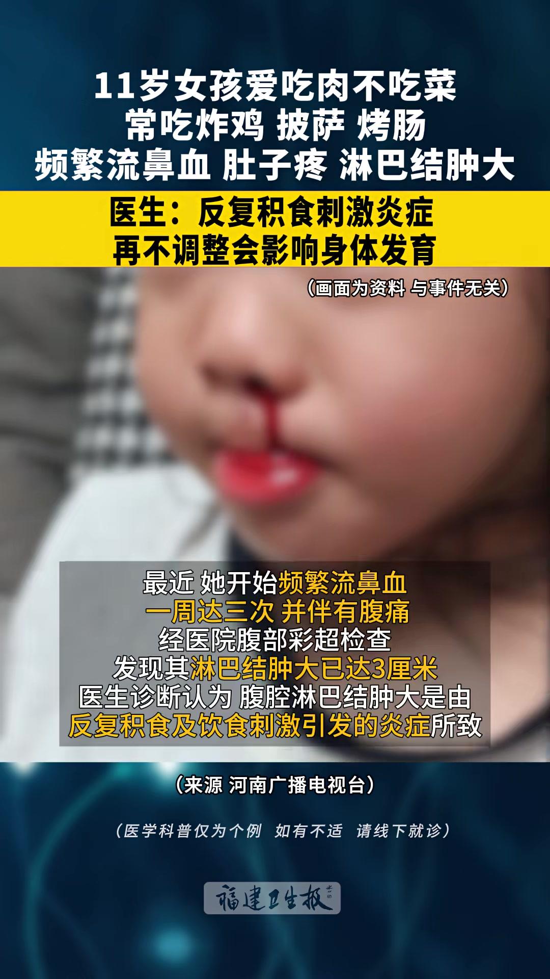 11岁女孩爱吃肉不吃 青菜常吃 炸鸡 披萨烤肠一周流3次鼻血 肚子疼淋巴结肿大医生:反复 